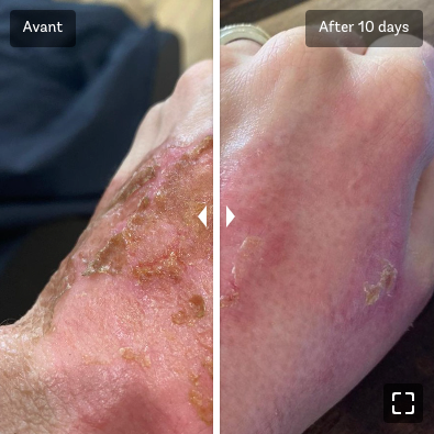 V-STAT | Gel réparateur avancé