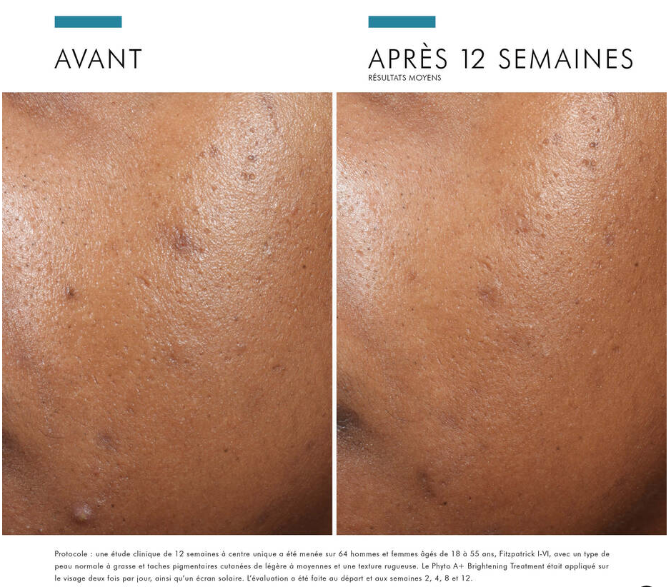 PHYTO A+ BRIGHTENING TREATMENT
